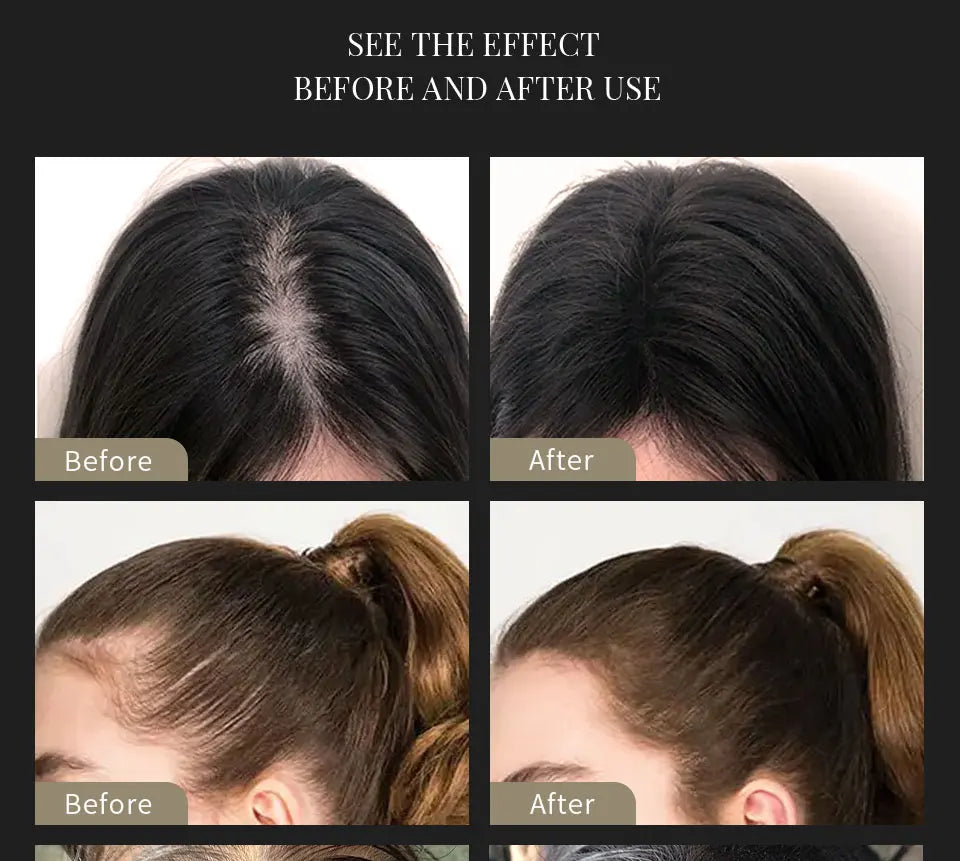 Orvia Hair™ – Sevich Hair Building Fiber Set