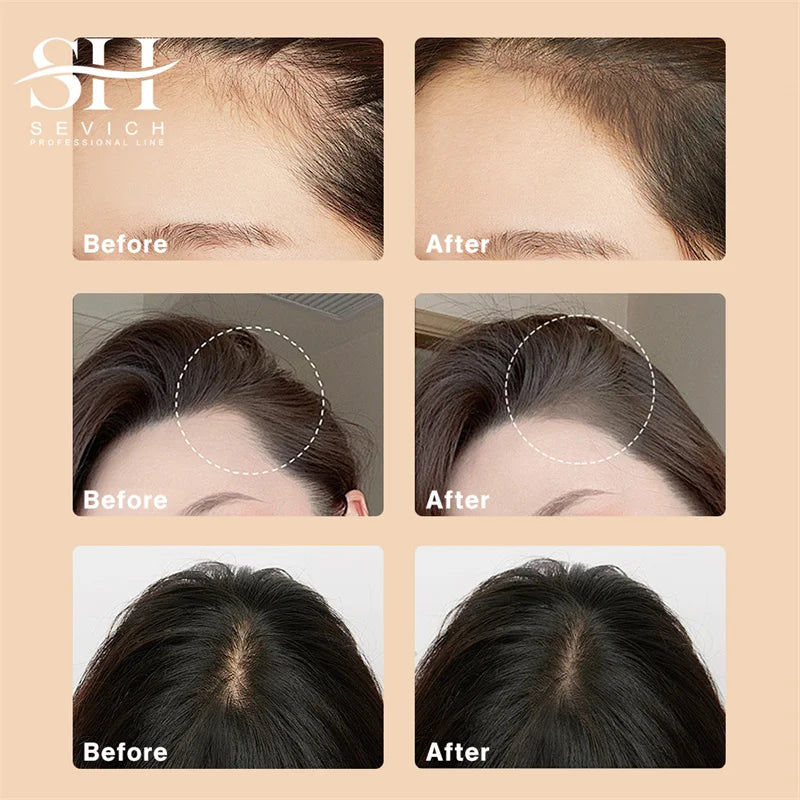 Orvia Hair™ – Sevich 5 Colors Hair Shadow Powder (12g)