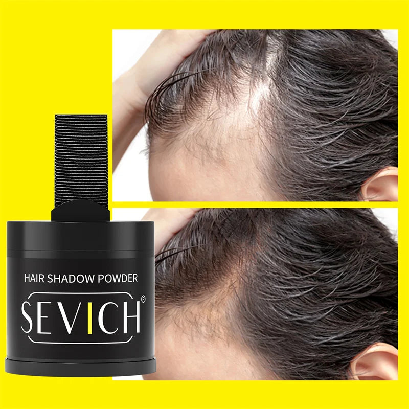 Orvia Hair™ | Sevich 10g Hairline Powder – Waterproof Hairline & Root Concealer